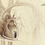 ZKO_Heartbeat-412x271